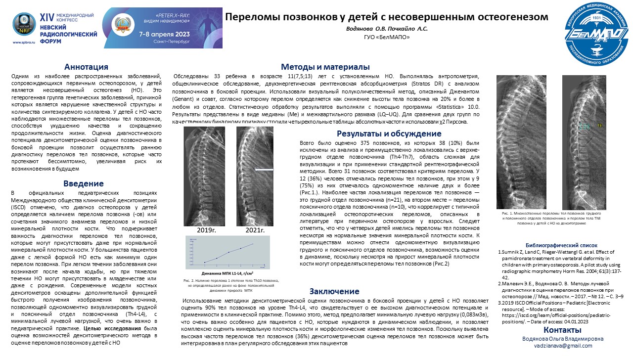 Трабекулярный костный индекс (ТКИ) у пациентов с сахарным диабетом 1-го типа