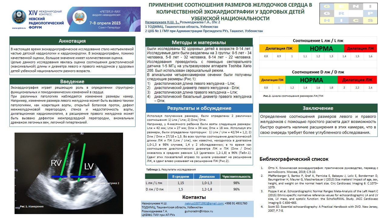 наз